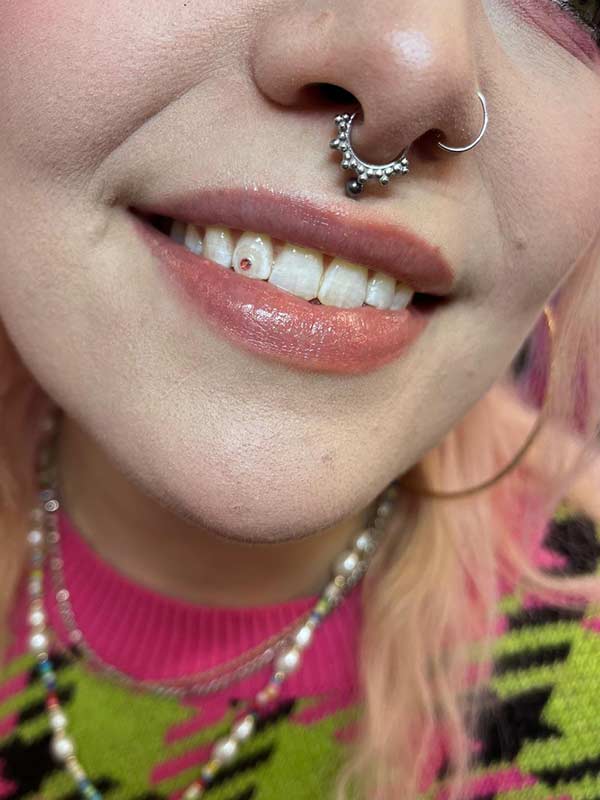 A client with Charmed Smile tooth gems